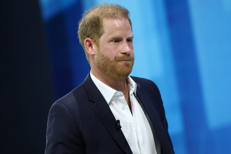 Balding Prince Harry needs a hair transplant ASAP, his boyhood hairdresser says